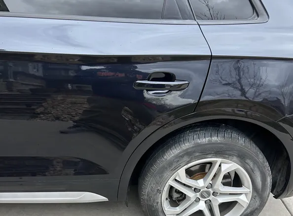 Dents