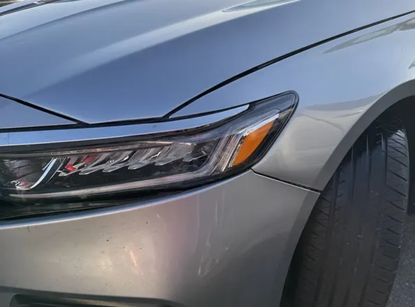 Dents