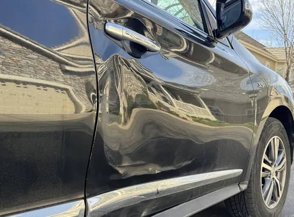 Dents