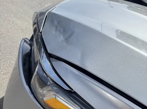 Dents
